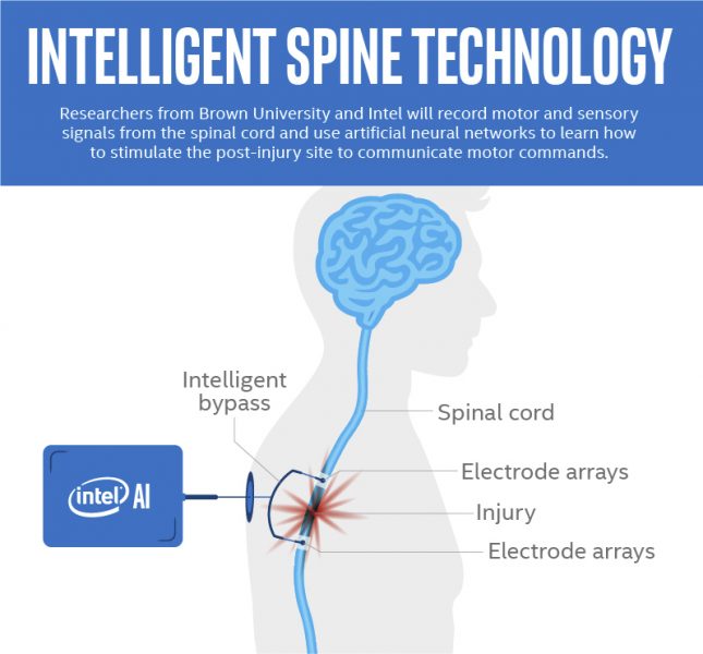 Intel And Brown University Research Will Use AI To Treat Spinal Cord ...