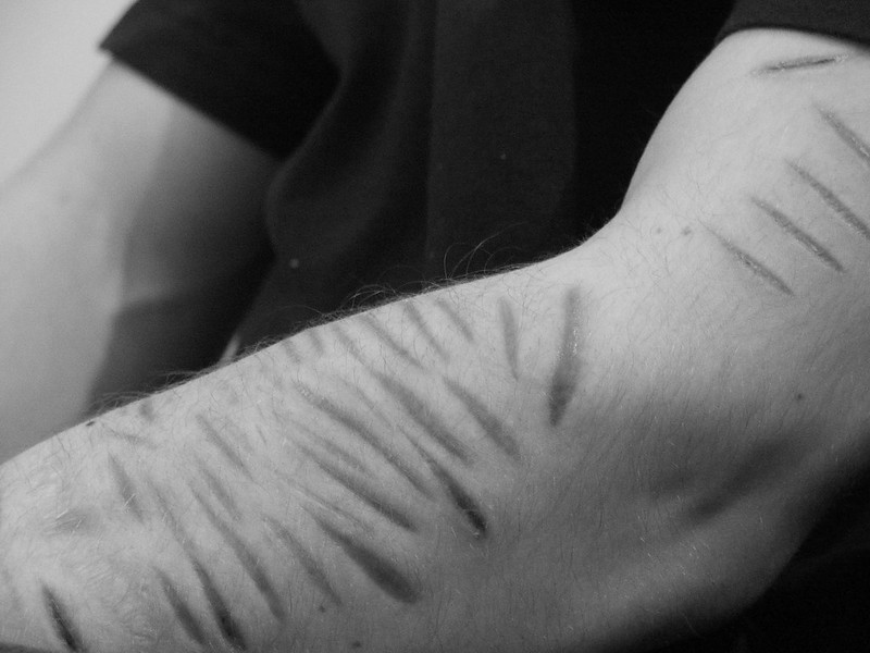 cutting scars on wrist black and white